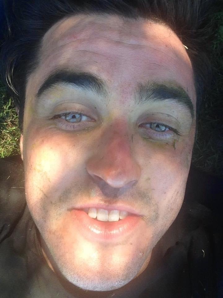 Davey Lloyd during his party years, close-up selfie